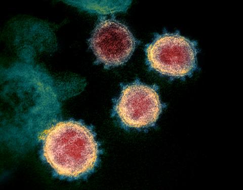 [CREDIT: CDC] An image of the novel coronavirus that causes COVID-19. A recent surge is waning, but remains above the threshold set for safe in-school attendance in 2020, and a new benchmark recommended by a health expert.