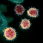 [CREDIT: CDC] An image of the novel coronavirus that causes COVID-19. Omicron variant tailored vaccines are now available, and the CDC recommends you get one even if you've gotten all the other available shots and boosters.